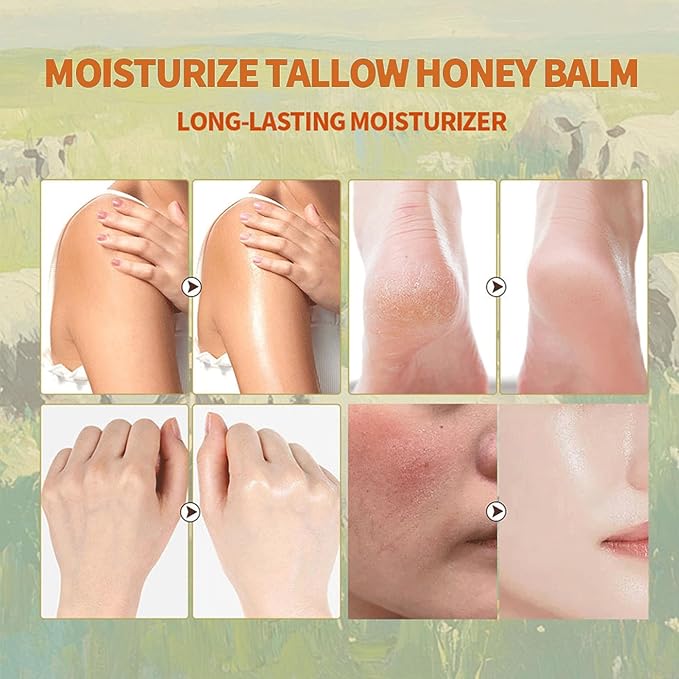 Grass Fed Beef Tallow for Skin Care, Whipped Beef Tallow for Skin, Beef Tallow Face Moisturizer Beef Tallow Cream Natural Organic Moisturizing Cream for Face & Body Lotion Skin Care for Sensitive Skin