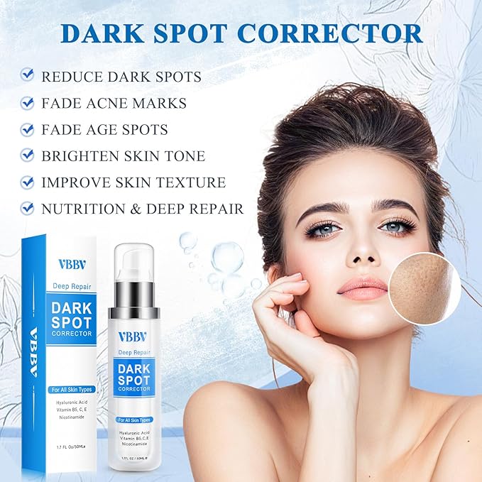 Dark Spot Remover for Face and Body, Dark Spot Corrector, Age Spot Sun Spot Freckles Dark Spot Remover, Melasma Treatment for Face, Advanced Skin Care Cream for Women and Men (1.7 Fl Oz)