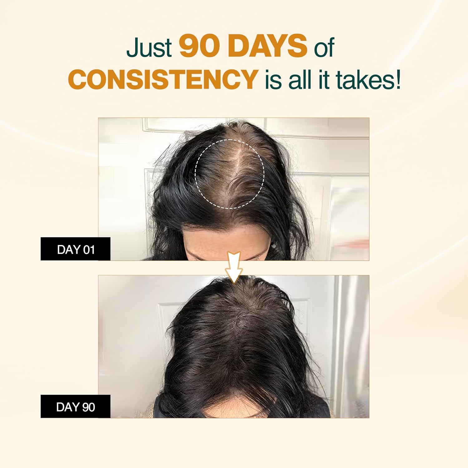 Nourish Mantra Advanced Hair Growth Serum 50ml, 3% Redensyl, 2% Anagain, 2% Procapil, 5% Rice Water, Promotes Hair Regrowth, Anti Thinning & Hair Loss Treatment,Rapid Hair Growth Serum for Women & Men