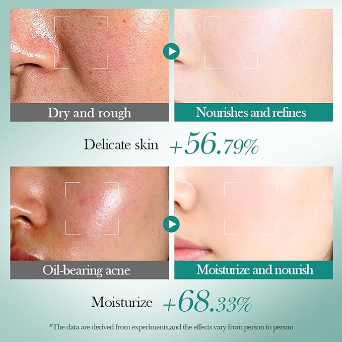 Hyaluronic Acid Skincare Set, Hydrated Skincare Gift Set for Women Skin Care Kit with Cleanser, Toner, Serum, Cream, Lotion, Eye Cream, Skincare Starter Kit for Women Hydrating Skin