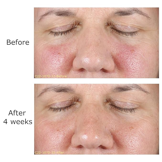 Hydrate & Soothe Beauty Collection Gift Bundle/Starter Kit, Activator with 0.025% Retinol Cream, Ramp-Up Regimen 1 & RHR Overnight Mask, Skin Care Routine, For All Skin Type