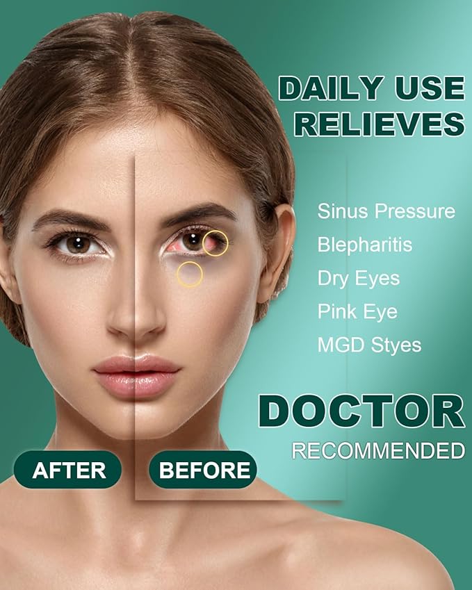 ProCIV 30 Packs Steam Eye Mask,Warm Compress for Dry Eyes Sleep Mask,Hot Auto Heated Eye Masks Relaxing Gifts for Women Moist Heat Soothing Eye Fatigue,Disposable Eye Mask for SPA Essentials