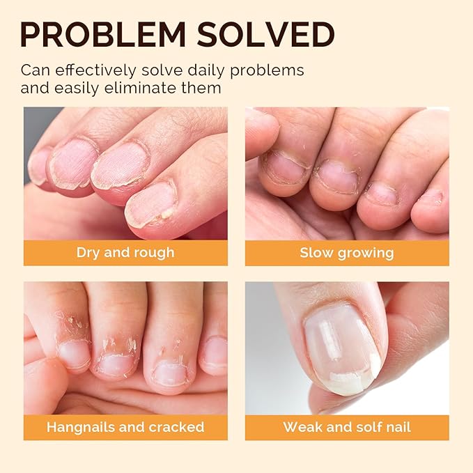 MelodySusie 12Pcs Cuticle Oil Pen Set,Nail Moisturizing Cuticle Oil Enriched with Vitamin E,Softens and Repairs cuticles,Nail Strengthener,Protects Damaged Skin,Thin Nails