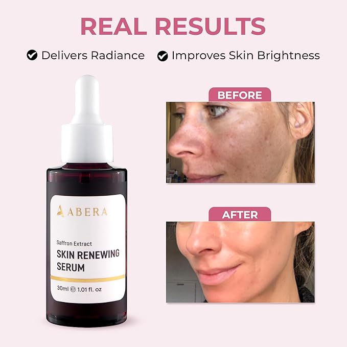 ABERA Saffron Serum For Melasma Treatment, Renewing for Face, Anti-Aging Serum for Fine Lines & Wrinkles, High Potency Saffron Extract, Hydrating Serum, Dark Spot Remover, 1.01 Fl Oz