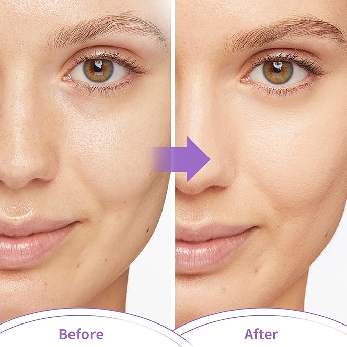 Cold Face Eye Masks Ice Face Mask Hot Cold Compress For Dark Circles, Puffiness, Migraines, Headache, Stress, Redness, Cooling Face Masks For Women Man, Skin Care