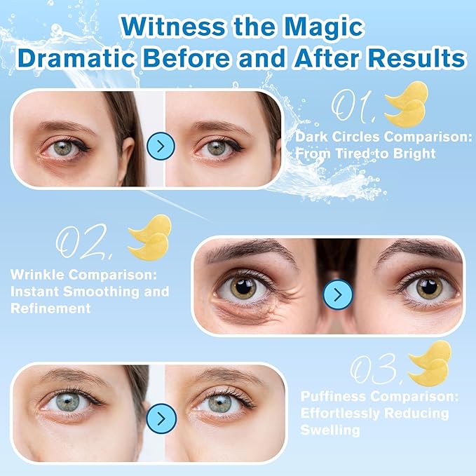 Gold Eye Patches 2-Pack (120 PCS) - Anti-Wrinkle & Firming Under Eye Gel Mask, Instantly Brighten Dark Circles, Luxury Collagen Treatment for Women, Wrinkle Patches for Eye Area