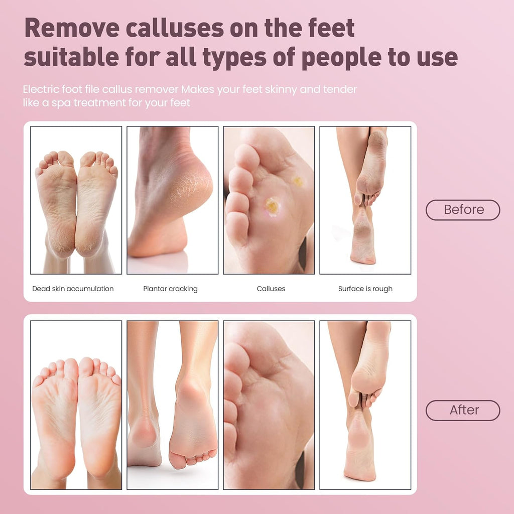 Electric Foot Callus Remover,2 in1 Rechargeable Callus Remover for Feet,9-Speed Wireless Electric Foot File Nail Grinder,Foot Scrubber Pedicure Tools for Dead Skin Dry Cracked Feet(Pink MINI)