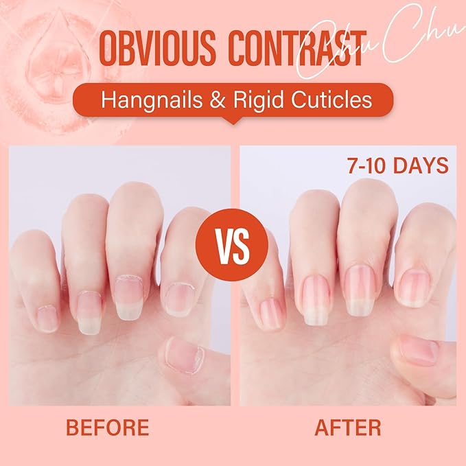 CHUCHU Organic Cuticle Oil for Nails: Peach Jojoba Nail Oil with Vitamin B & E - Moisturizes Repairs and Promotes Nail Growth - Prevents Dryness Hangnails and Chapped Skin 15ML