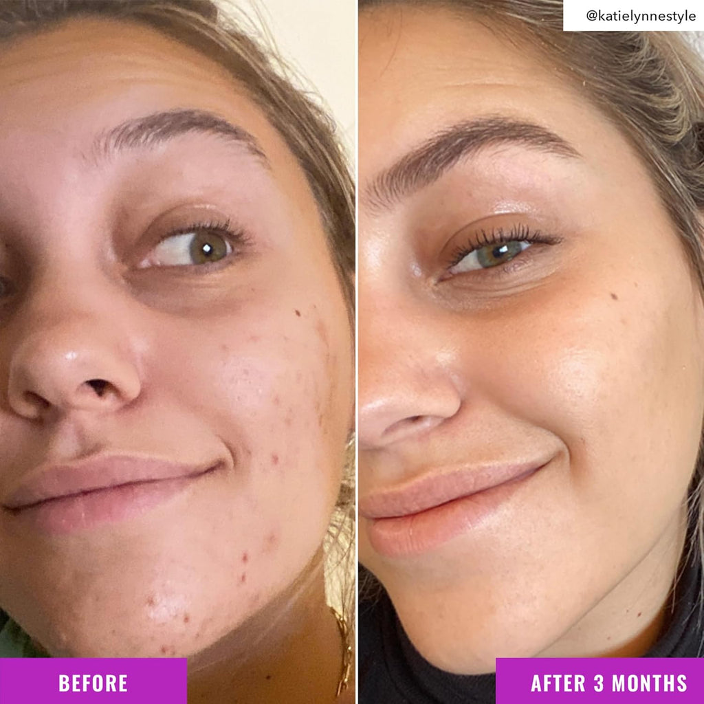 Good Molecules Niacinamide Brightening Toner - Toner for Face with Niacinamide and Arbutin for Skin Tone Balancing- Pore Minimizer, Facial Skin Care