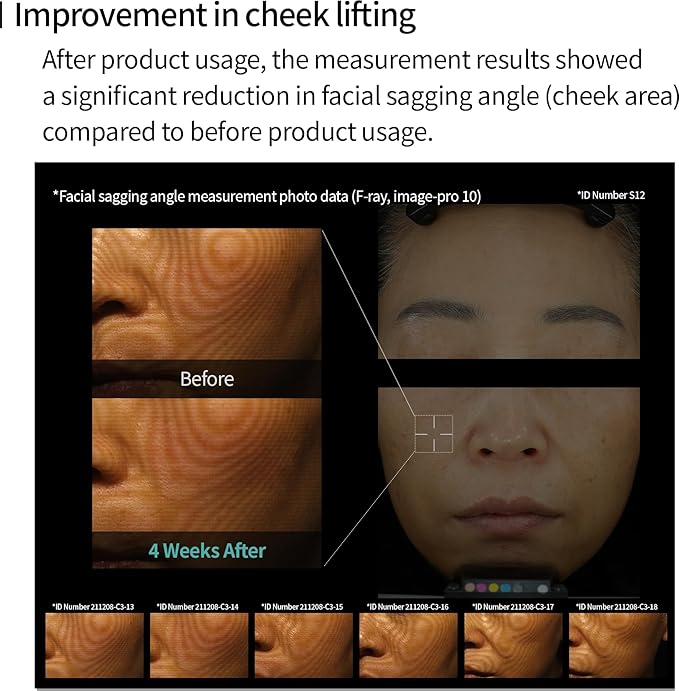 Edelweiss Lifting Serum – Anti-Aging Formula with Edelweiss Extract, Niacinamide, Peptides for Firming, Hydration & Brightening – 1.35 fl.oz