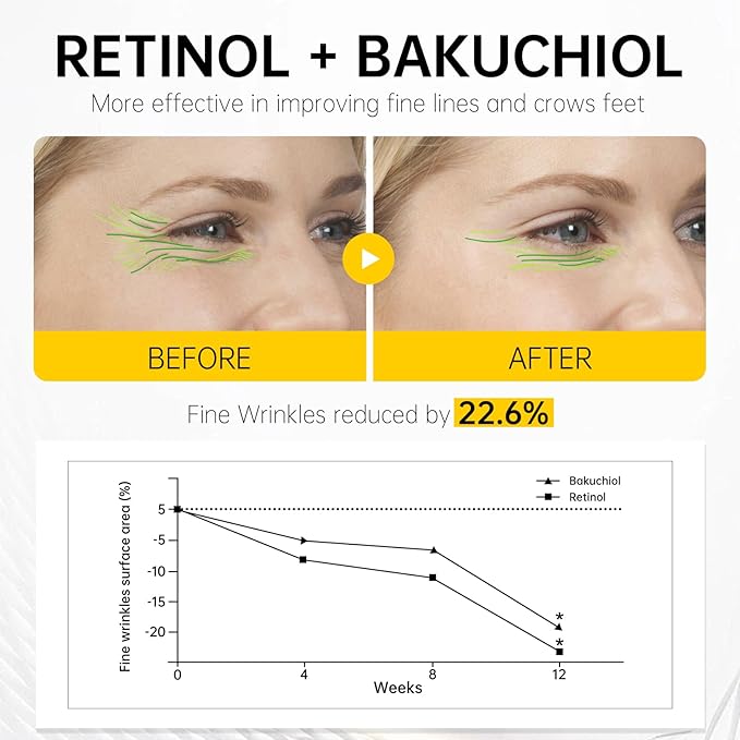 VGO Retinol Eye Cream, Anti-Aging Eye Cream for Dark Circles & Puffiness with 1% Retinol, 1% Bakuchiol & 6% Caffeine to Reduce Wrinkles, Fine Lines, De-puff and Eye Bags, 0.52 oz/15g, Made in USA