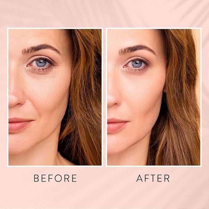 Skin Renewing Retinol Serum for Face Anti Aging & Pore Refining - Firming Serum for Fine Lines - Resurfacing Retinol Serum for Acne Marks - Retinol for Beginners Mild Formula 0.1%