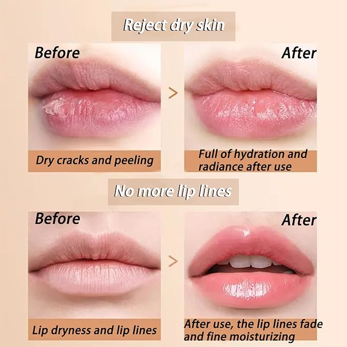 6 PCS Bee Lip Balm Honey Pot, Honey Strawberry Watermelon Apple Lime Mint Cherry Lip Mask Propolis Moisturizing Sleeping Lip Mask Overnight with Sticks, Honey Lip Balm Prevention Dry