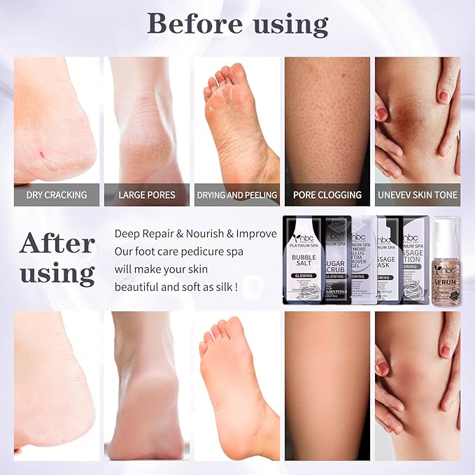 Pedicure Foot Soak Set - Upgraded 6 in 1 Foot Spa, Foot Bath Spa, Pedicure Kit, Foot Soak for Tired & Dry Cracked Feet, Athletes Feet, Bad Odor, Softens Calluses,Golden Petals