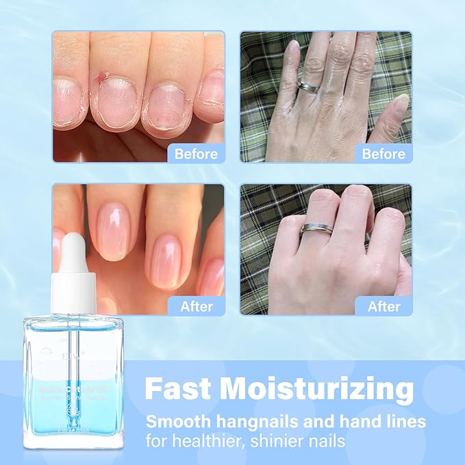 EJW Dual Layer Cuticle Oil for Nails - Nourishes & Repairs Dry, Damaged Cuticles, Strengthens Nails, Reduces Hangnails & Hand Lines, Fast-Absorbing Natural Formula, Ocean Breeze Scent, 0.5 fl. oz