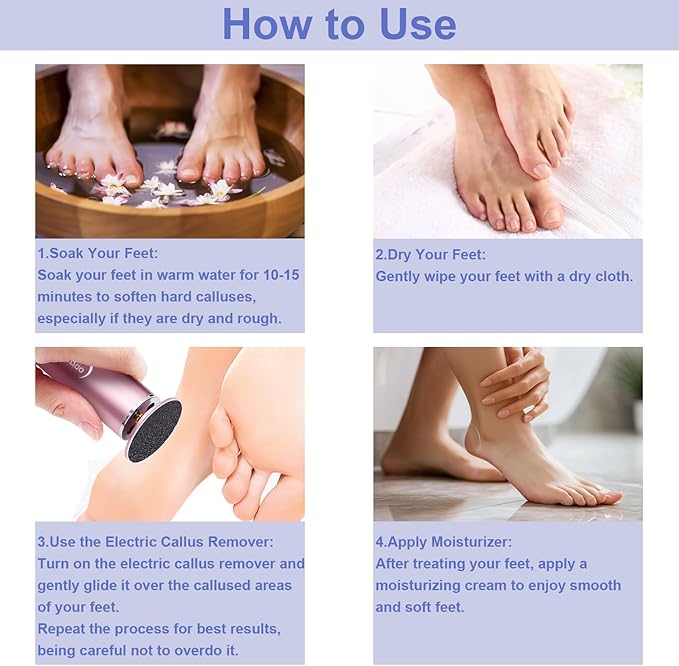 Electric Foot File - High Torque,Callus Remover for Feet,Adjustable Speed Foot File with 60 Pcs Sandpaper Discs,Professional Pedicure Tool for Dead Skin and Calluses (Blue)