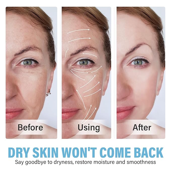 Azelaic Acid for Face, Azelaic Acid Serum for Sensitive Skin, Facial Skin Care Serum Reduces Redness, Balances Tone and Moisturizes Deeply, 30ml