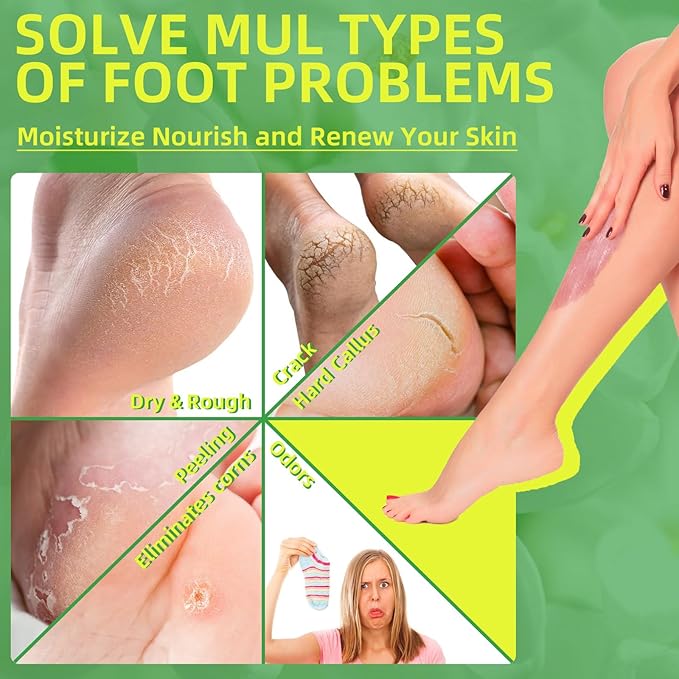 Foot Exfoliating Scrub, Sugar Scrub, Dead Skin Remover for Feet, Individually Packaged Foot Scrub Smooths, Hydrates, Detoxifies Tired and Dry Cracked Feet 16 Packs per Box, Jasmine