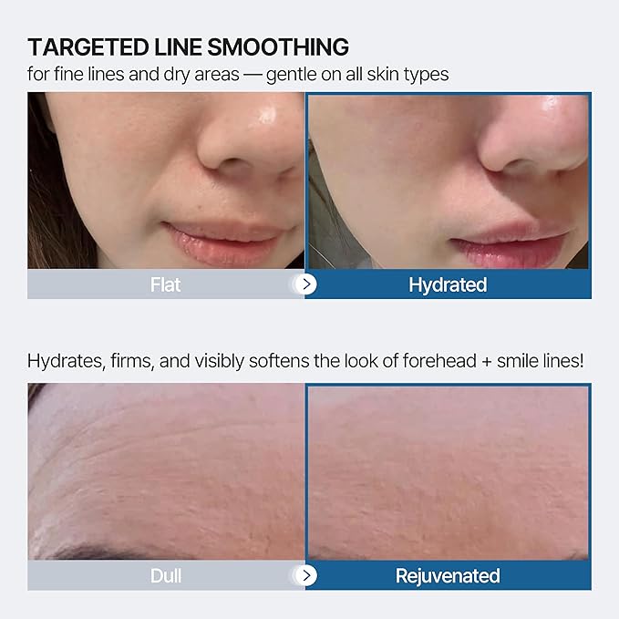 Forehead and Smile Line Wrinkle Patches - Anti Wrinkle Patches for Lip - Face Tape Overnight Self Care for Woman for Smoothing and Firming - Smile Line Patches (6 Pack)