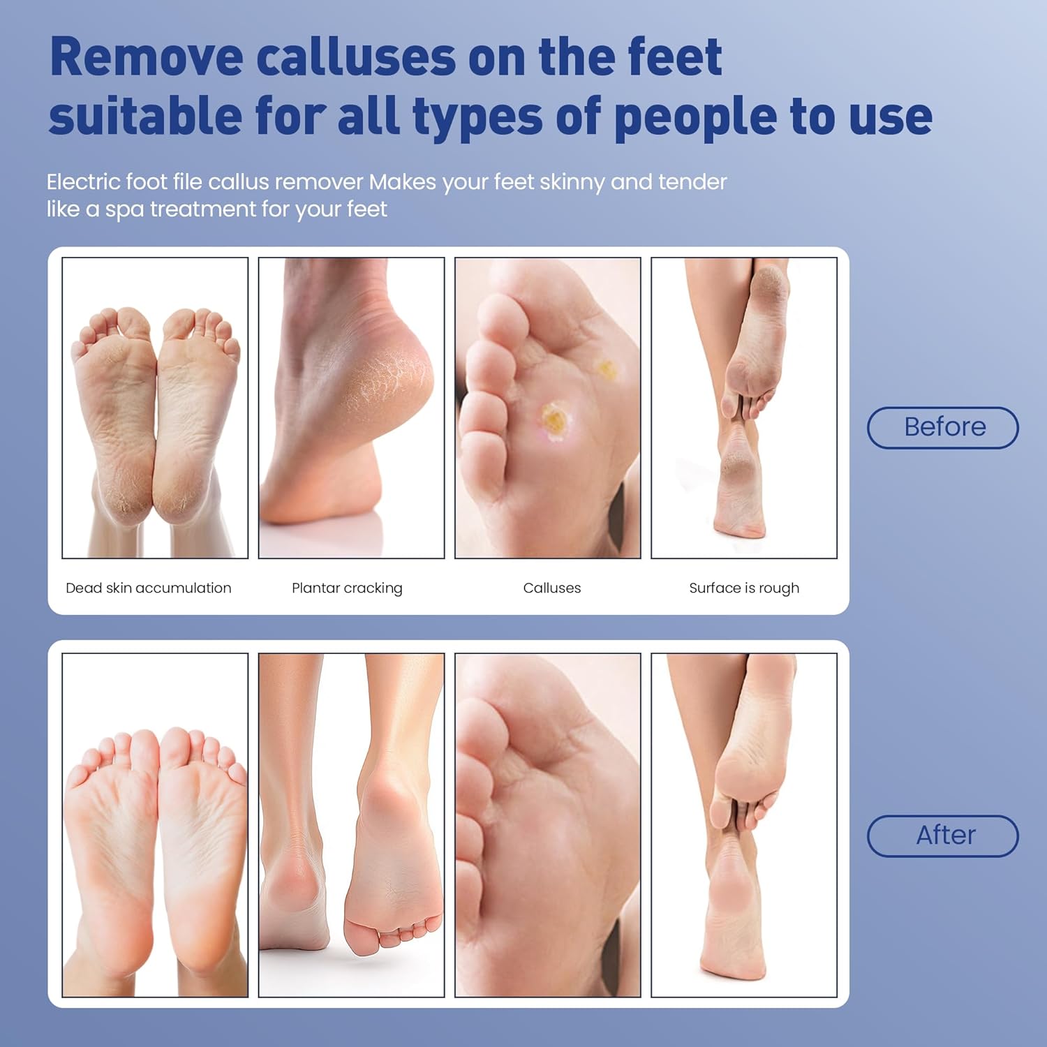 Electric Foot Callus Remover,2 in1 Rechargeable Callus Remover for Feet,9-Speed Wireless Electric Foot File Nail Grinder,Foot Scrubber Pedicure Tools for Dead Skin Dry Cracked Feet(Black MINI)