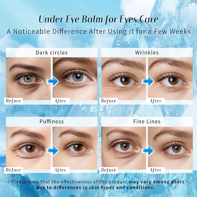 Eye Balm for Dark Circles: Cooling Eye Cream Under Eye Treatment, Cool Eye Stick Reduce Wrinkle & Puffiness, Hydrating Balm for Eye Bags Skin Care