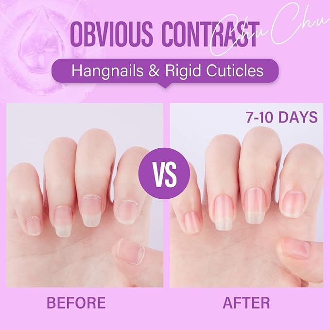 CHUCHU Organic Cuticle Oil for Nails: Blueberry Jojoba Nail Oil with Vitamin B & E - Moisturizes, Repairs, and Promotes Nail Growth - Prevents Dryness, Hangnails, and Chapped Skin 15ML