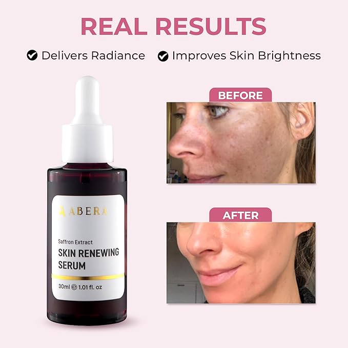 ABERA Saffron Serum For Melasma Treatment, Renewing for Face, Anti-Aging Treatment for Fine Lines & Wrinkles, High Potency Saffron Extract, Hydrating Serum, Dark Spot Remover (2 BOXES)