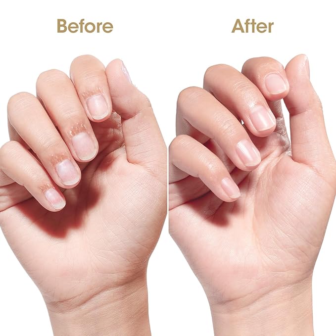 Gellen Nail and Cuticle Oil for Growth Strength, Radiant Vitamin E Nail Growth Oil, Organic Skin Cuticle Nail Care Moisturizer Nourishing Oil for Hydrating, Moisturizing, Strengthening, Repairing