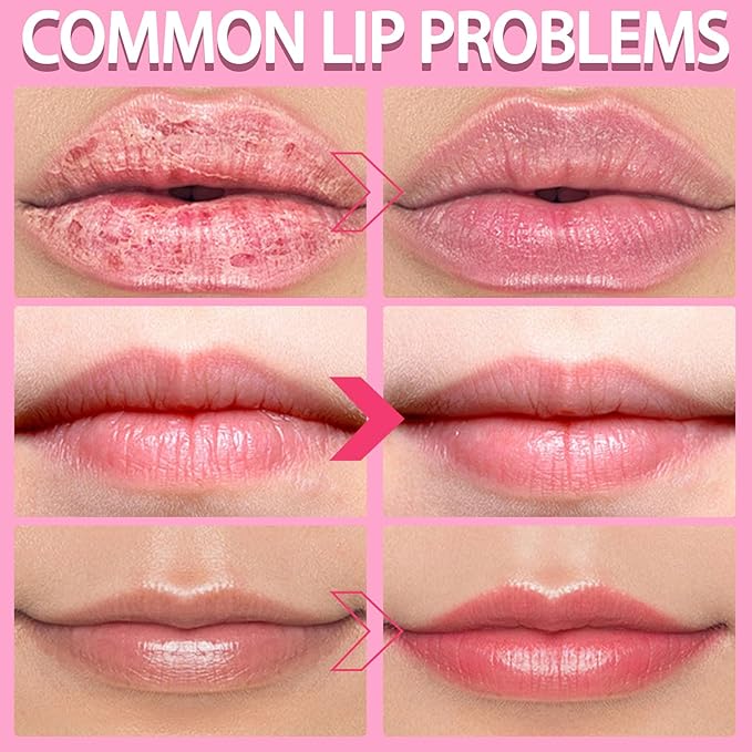 2PCS Lip Scrub Exfoliator,Gentle Lip Scrubber Exfoliator,Lip Exfoliator Scrub for Daily Lip Care,Lip Moisturizer for Nourishing Lip（Peach, Avocado）