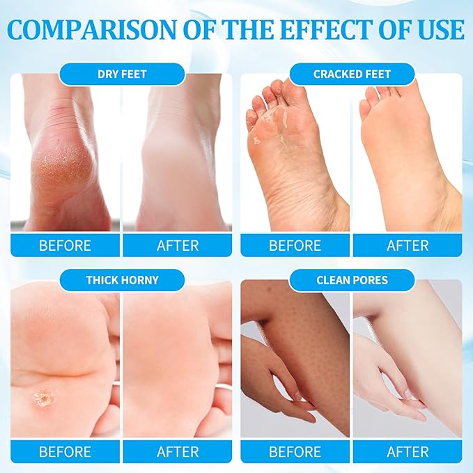 Pedicure Kit Foot Soak Set: Bubble Salt, Sugar Scrub, Massage Mask, Massage Lotion in a Box, 4 Step Foot Spa Kit for Dry Feet, Calluses and Tired Feet(3 Set Pacific Waves)