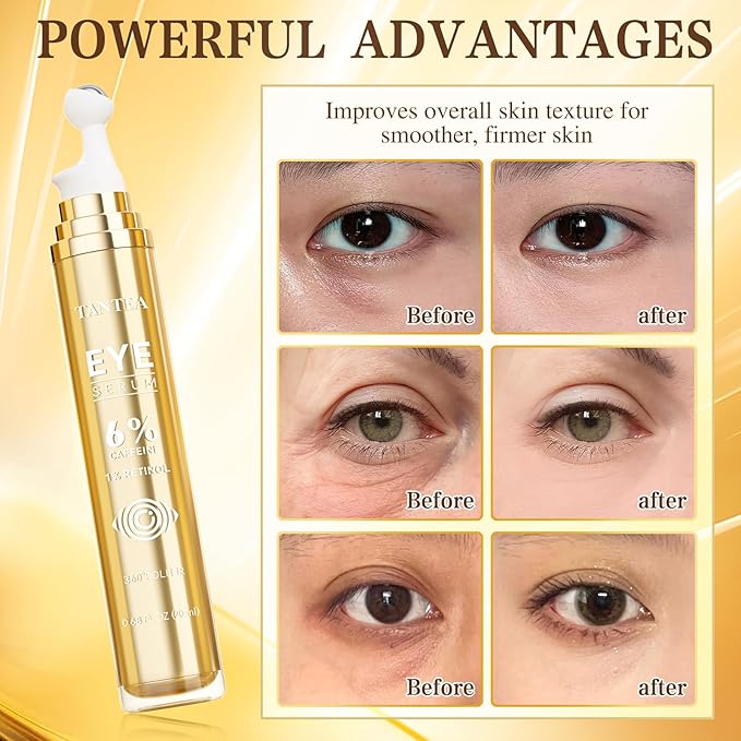 6% Caffeine Eye Cream for Puffy Eyes & Dark Circles, 1% Retinol Eye Serum for Under Eye Bags, Anti-Aging Eye Treatment for Men and Women