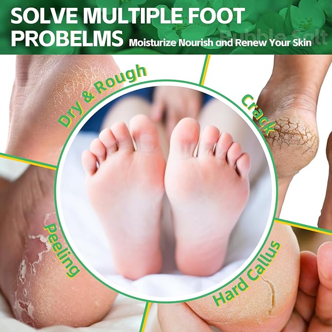 Pedicure Foot Soak, Foot Spa Soak, Pedicure Kit, Bubble Foot Bath For Tired & Dry Cracked Feet, Athletes Feet, Odor Foot and Softens Calluses, Foot Soak 16 Packs A Box, Jasmine