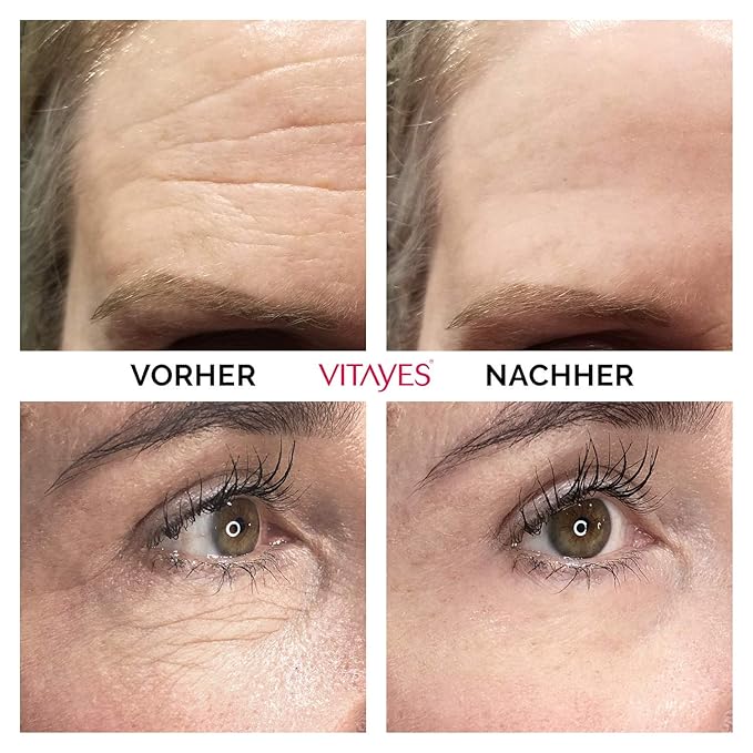 VITAYES Instant Ageback Lifting Cream, Dark Circle Bags Under Eye Remover, Anti Wrinkle and Fine Lines Face Lift Cream 0.24 Oz