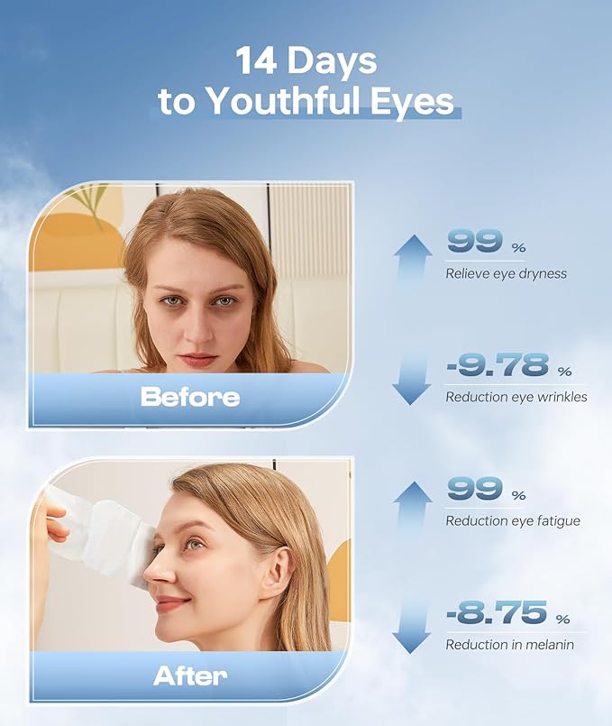 28 Pack Steam Eye Mask，Hyaluronic Acid Self Heating Warm Compress for Eyes, Heated Eye Mask for Fast Relief of Dry Eyes, Moisturizing & Highly Effective Steam Eye Mask