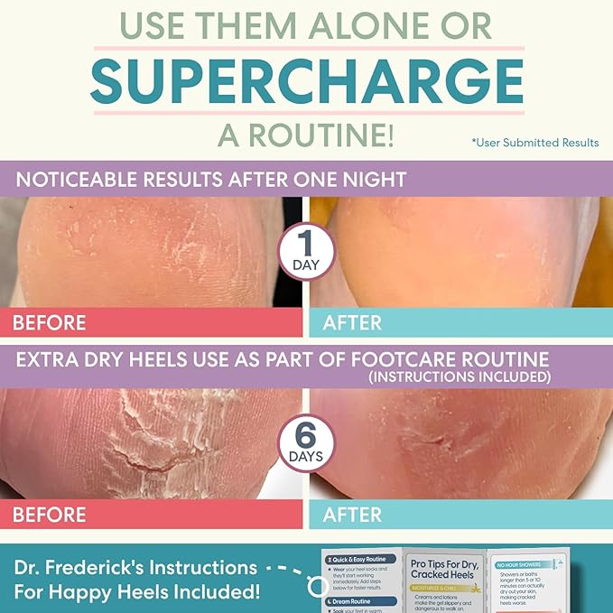 Dr. Frederick's Original Moisturizing Heel Socks for Cracked Heel Treatment - 2 Pairs - Stop Cracked Heels in Their Tracks