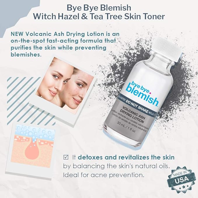 Bye Bye Blemish Drying Lotion Volcanic Ash | Acne Drying Solution To Assist With Blemish Prevention | 1 Fl. Oz.
