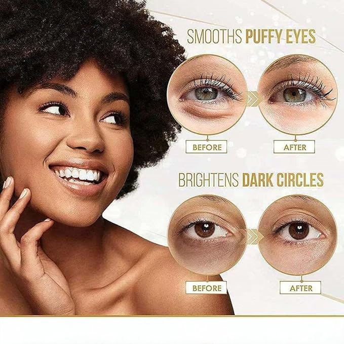 Hyaluronic Acid Eye Patch (Removes Dark Circles, Eye Bags, Eye Care, Wrinkles, Puffy Eyes, Skin Cushioning) - Anti-Aging Moisturising 60PCS. For both men and women