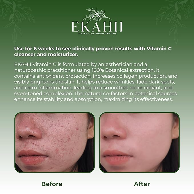 Vitamin C Face & neck moisturizer, Dark Spot Remover, Vit C Serum w Hyaluronic Acid, Rosehips, Noni, Amalaki, Orange, Acerola Cherry, Mango Butter- Anti Aging & Skin Brightening - Ayurvedic