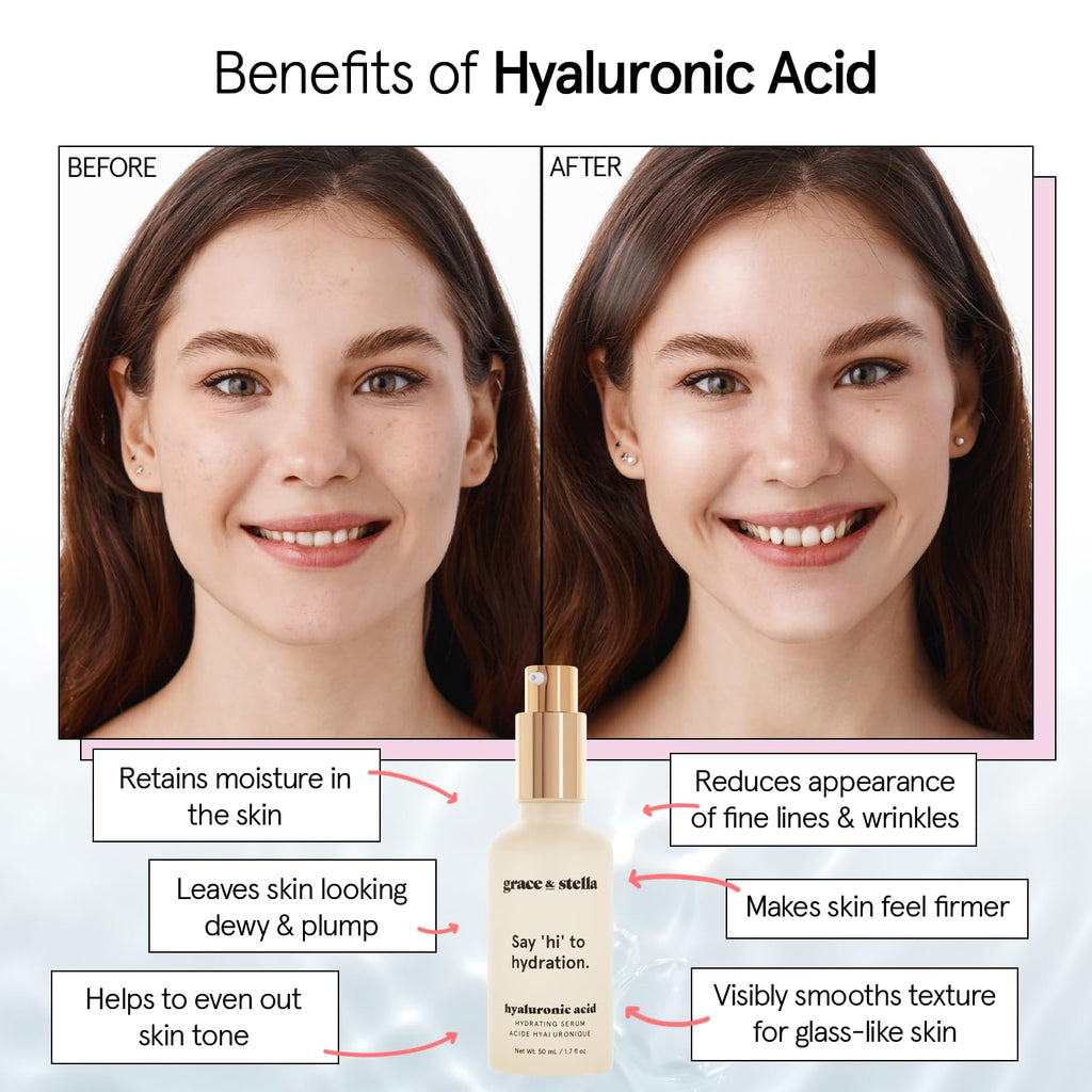 grace & stella Award Winning Hyaluronic Acid Face Serum (50ml/1.7 fl oz) Removes Fine Lines & Wrinkles, Hydrating Hyaluronic Acid Serum for Face, Acido Hialuronico for Women - Vegan Skincare (2-Pack)