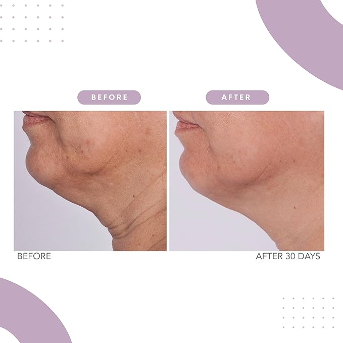 Serious Skincare Reverse Lift Trio Skin Firming Set - Tighten, Lift and Sculpt Face, Chin and Neck - Peptides - Hydrolyed Collagen - (3pack)