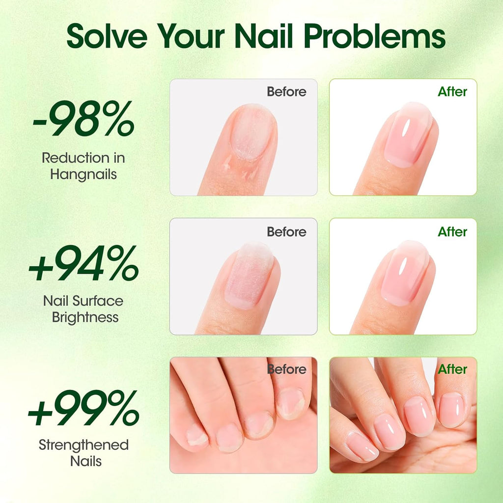 Gellen Cuticle Oil, Roll-On Nail Growth Oil, Nail Oil for Nail Growth & Repair & Strength, Green Citrus Avocado Baobab Oils Vitamin E, Nail Care for Damaged Skin & Thin Nails, Soften & Nourish Cuticle