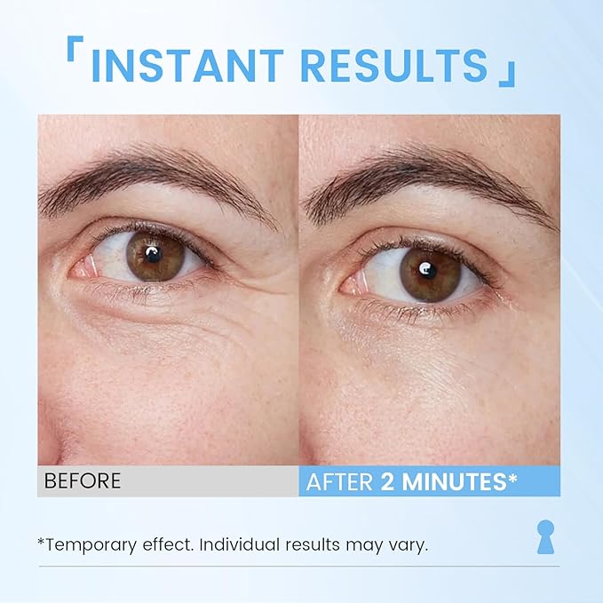 Instant Face Lift Cream: Rapid Reduction Eye Serum Firms Under Eye Bags and Wrinkles for Middle-aged Women Before Dating & Work 1 Fl Oz