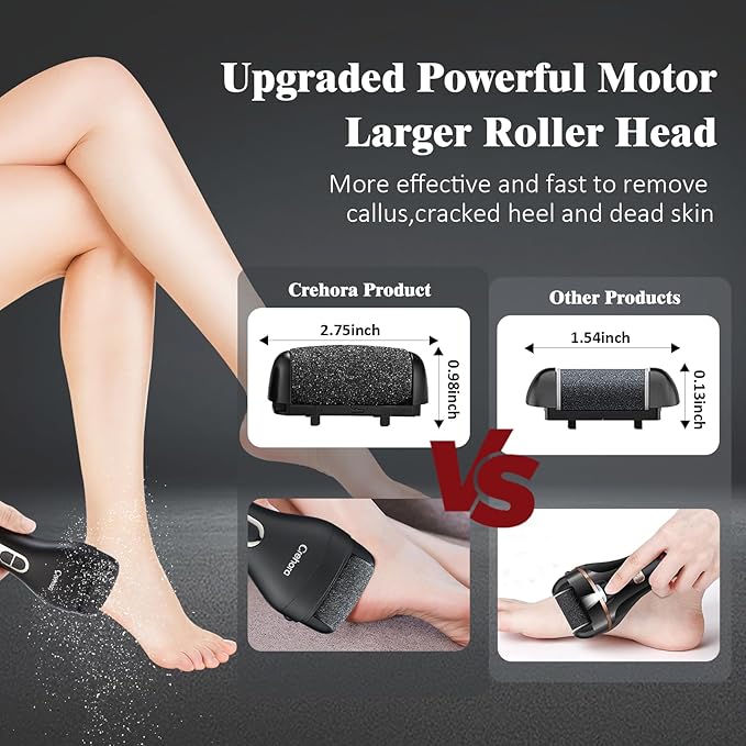 Rechargeable Electric Foot Callus Remover - Waterproof Pedicure Tool for Hard, Cracked, Dry Skin