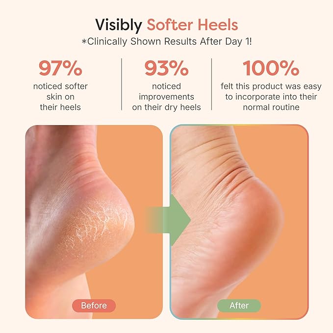 ZenToes Moisturizing Socks for Cracked Heel Treatment - Vitamin E, Olive Oil and Jojoba Oil Infused Heel Socks to Soften and Hydrate (Fuzzy Pink, Regular)