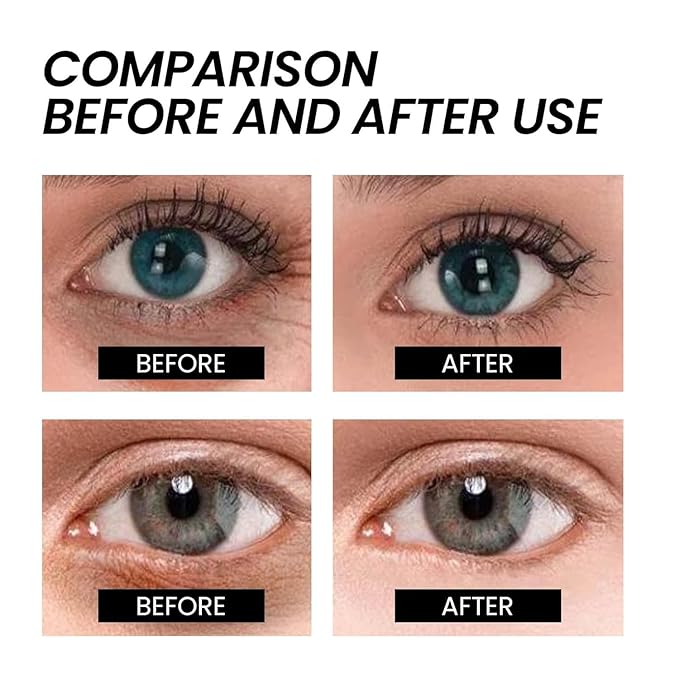 Naturals Instant Eye & Face Lift Cream Rapid Under Eye Bags Wrinkles Puffiness Remover for Women and Men in 60s -Temporary Firming & Tightening Treatment - Wrinkle Filler (2pcs)