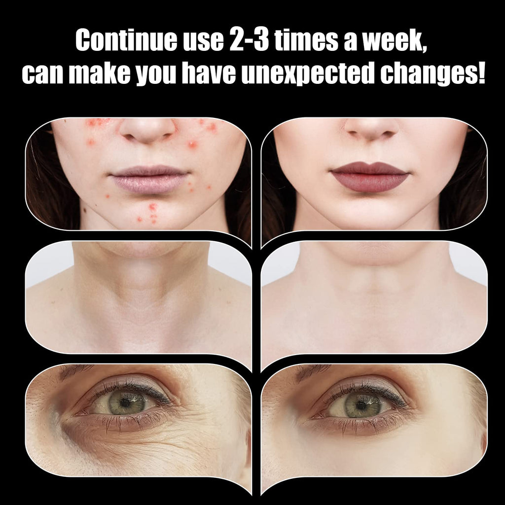 High Frequency Facial Wand - UUPAS Portable High Frequency Facial Machine with 6 Pcs Different Tubes（Orange & Purple）