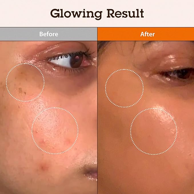 BLITHE Skin Radiance Duo – Pressed Serum & Niacinamide Tranexamic Acid Serum | Dark Spot Corrector & Hydrating Moisturizer | Korean Skincare for Clear, Glowing Skin