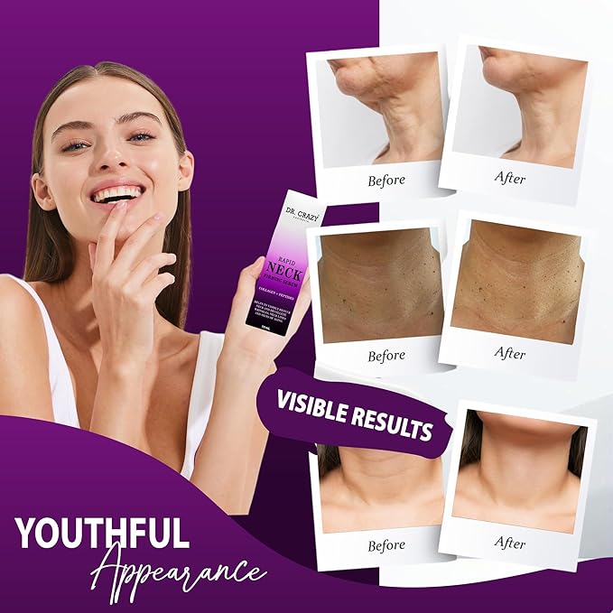 Bag Buster Eye Cream - Rapid Firming and Anti-Wrinkle Neck Serum | Face Serum for Women