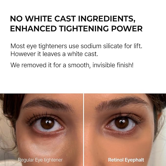 Retinol Eyebag Cream for Puffiness, Dark Circles & Fine Lines, Wrinkle, EGF Anti-Aging Under Eye Moisturizer with Niacinamide&Ceramide Makeup friendly korean skin care