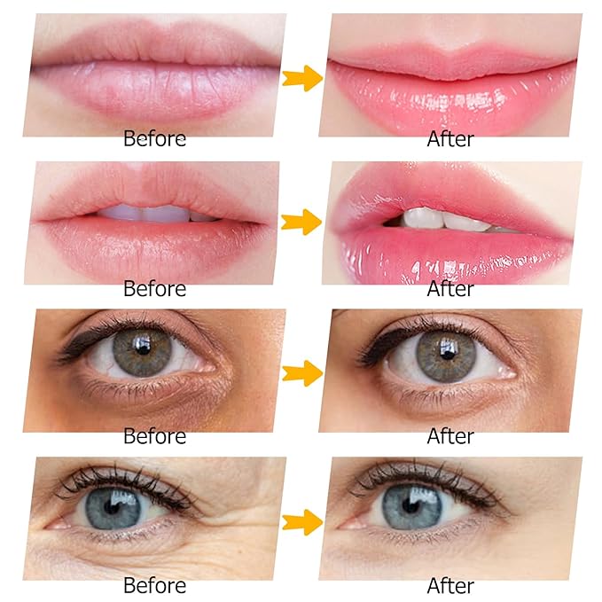 40 Pairs Gold Lip Masks & Eye Masks,24K Gold Gel Collagen Eye Patches for Puffy Eyes, Dark Circles and Wrinkles, Collagen Crystal Mask Set for Face care